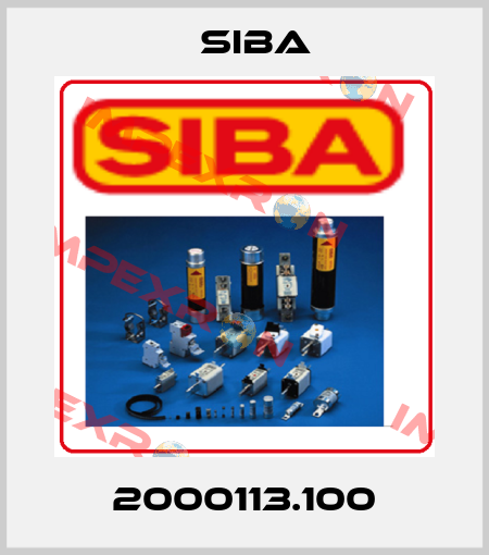 2000113.100 Siba